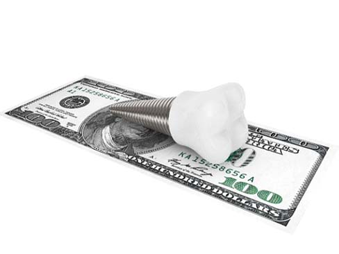 dental implant and money for cost of dental implants in Garland